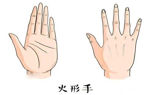 火型手