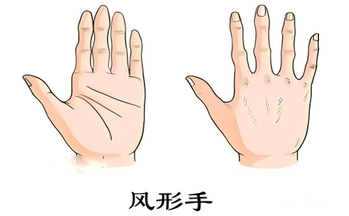 风型手